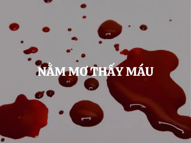 Nằm Mơ Thấy Máu Đánh Con Gì? Giải Mã Điềm Báo & Con Số May Mắn Trong Lô Đề Nằm Mơ Thấy Máu Đánh Con Gì? Giải Mã Điềm Báo & Con Số May Mắn Trong Lô Đề
