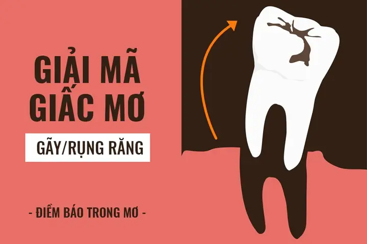 Giải Mã Giấc Mơ Rụng Răng Khểnh: Ý Nghĩa, Nguyên Nhân Và Cách Giải Thích