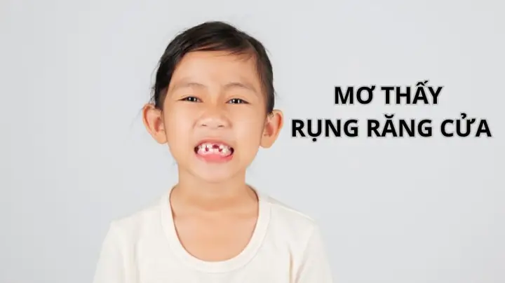 Giải Mã Giấc Mơ Rụng Răng Khểnh: Ý Nghĩa, Nguyên Nhân Và Cách Giải Thích
