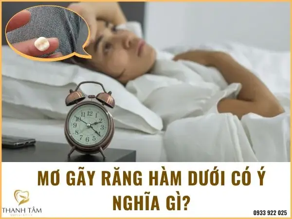 Giải Mã Giấc Mơ Thấy Bị Gãy Răng: Điềm Báo Tốt Hay Xấu Theo Từng Trường Hợp Chi Tiết