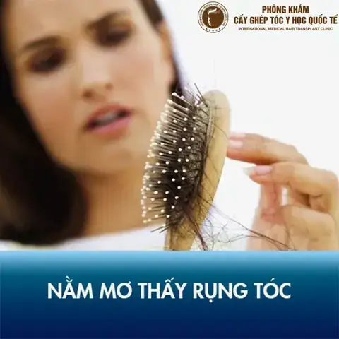 Giải Mã Giấc Mơ Thấy Hôn Người Lạ: Điềm Báo Gì, Tốt Hay Xấu Và Con Số May Mắn? Giải Mã Giấc Mơ Thấy Hôn Người Lạ: Điềm Báo Gì, Tốt Hay Xấu Và Con Số May Mắn?