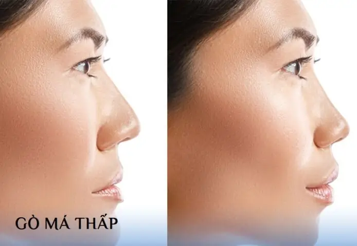 Gò Má Thấp Nhân Tướng Học Gò Má Thấp Nhân Tướng Học
