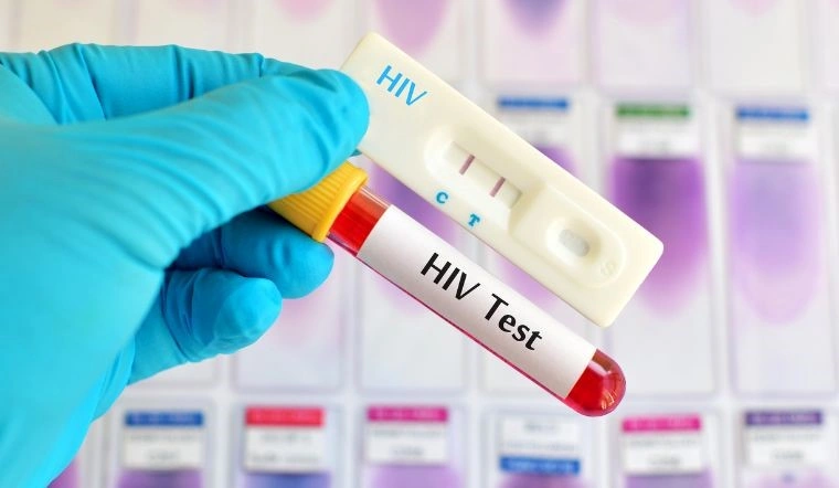 100+ Hình Ảnh Bệnh Nhân Hiv 2026 – Bộ Sưu Tập Đầy Đủ, Đẹp Nhất, Tải Miễn Phí, Bạn Đã Xem Chưa? 100+ Hình Ảnh Bệnh Nhân Hiv 2026 – Bộ Sưu Tập Đầy Đủ, Đẹp Nhất, Tải Miễn Phí, Bạn Đã Xem Chưa?