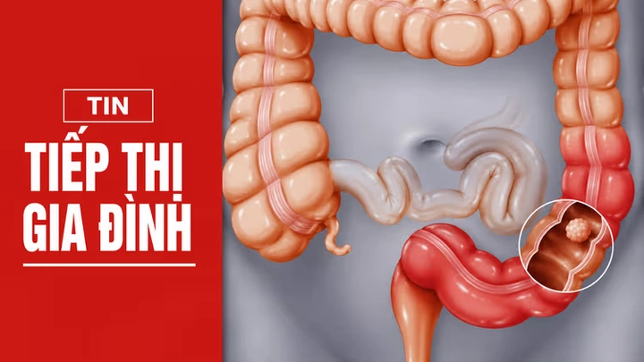 100+ Hình Ảnh Bộ Phận Con Người Đẹp 2026 – Bạn Muốn Xem Bao Nhiêu?