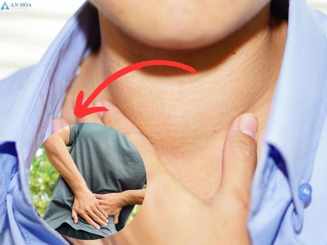 100+ Hình Ảnh Bướu Cổ Đơn Thuần 2026 - Bộ Sưu Tập Độc Đáo, Đẹp Nhất 100+ Hình Ảnh Bướu Cổ Đơn Thuần 2026 - Bộ Sưu Tập Độc Đáo, Đẹp Nhất