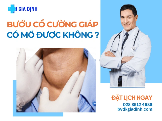 100+ Hình Ảnh Bướu Cổ Đơn Thuần 2026 - Bộ Sưu Tập Độc Đáo, Đẹp Nhất 100+ Hình Ảnh Bướu Cổ Đơn Thuần 2026 - Bộ Sưu Tập Độc Đáo, Đẹp Nhất