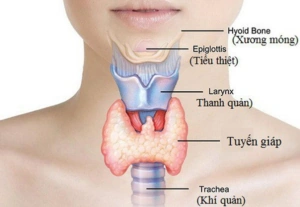 100+ Hình Ảnh Bướu Cổ Đơn Thuần 2026 - Bộ Sưu Tập Độc Đáo, Đẹp Nhất 100+ Hình Ảnh Bướu Cổ Đơn Thuần 2026 - Bộ Sưu Tập Độc Đáo, Đẹp Nhất