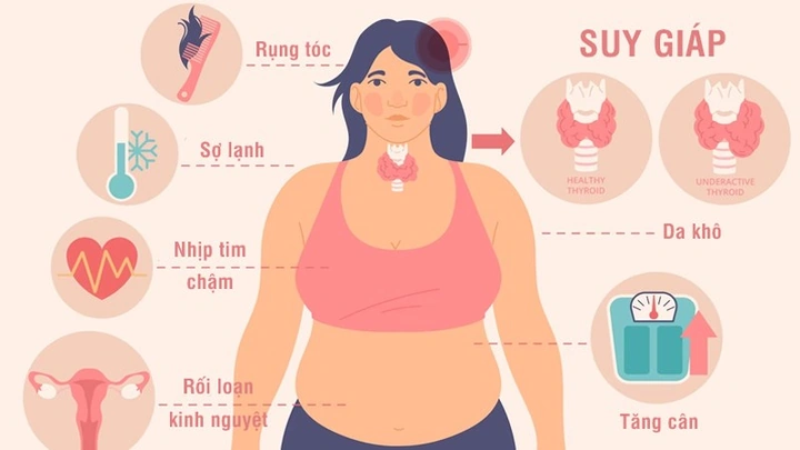 100+ Hình Ảnh Bướu Cổ Đơn Thuần 2026 - Bộ Sưu Tập Độc Đáo, Đẹp Nhất 100+ Hình Ảnh Bướu Cổ Đơn Thuần 2026 - Bộ Sưu Tập Độc Đáo, Đẹp Nhất