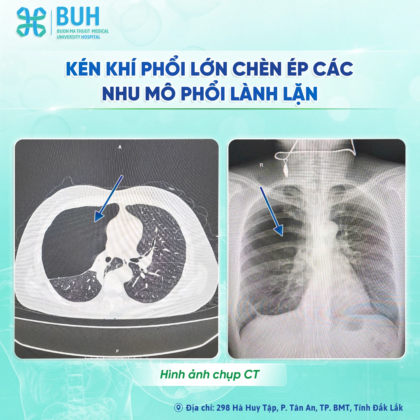 100+ Hình Ảnh Các Loài Khỉ Đầy Màu Sắc 2026, Bộ Sưu Tập Đẹp Nhất Cho Wallpaper, Avatar, Và Đồ Họa? 100+ Hình Ảnh Các Loài Khỉ Đầy Màu Sắc 2026, Bộ Sưu Tập Đẹp Nhất Cho Wallpaper, Avatar, Và Đồ Họa?
