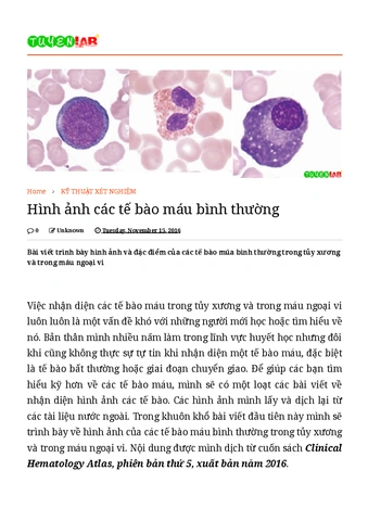 100+ Hình Ảnh Các Tế Bào Máu Đầy Màu Sắc & Độ Phân Giải Cao 2026 – Bạn Đã Sẵn Sàng Thấy Mọi Chi Tiết Nhỏ Nhặt?