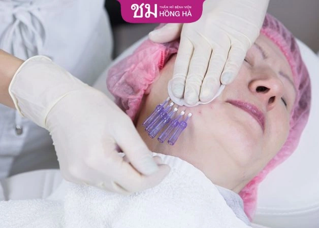 100+ Hình Ảnh Căng Chỉ Collagen 2026 - Bộ Sưu Tập Đẹp Nhất