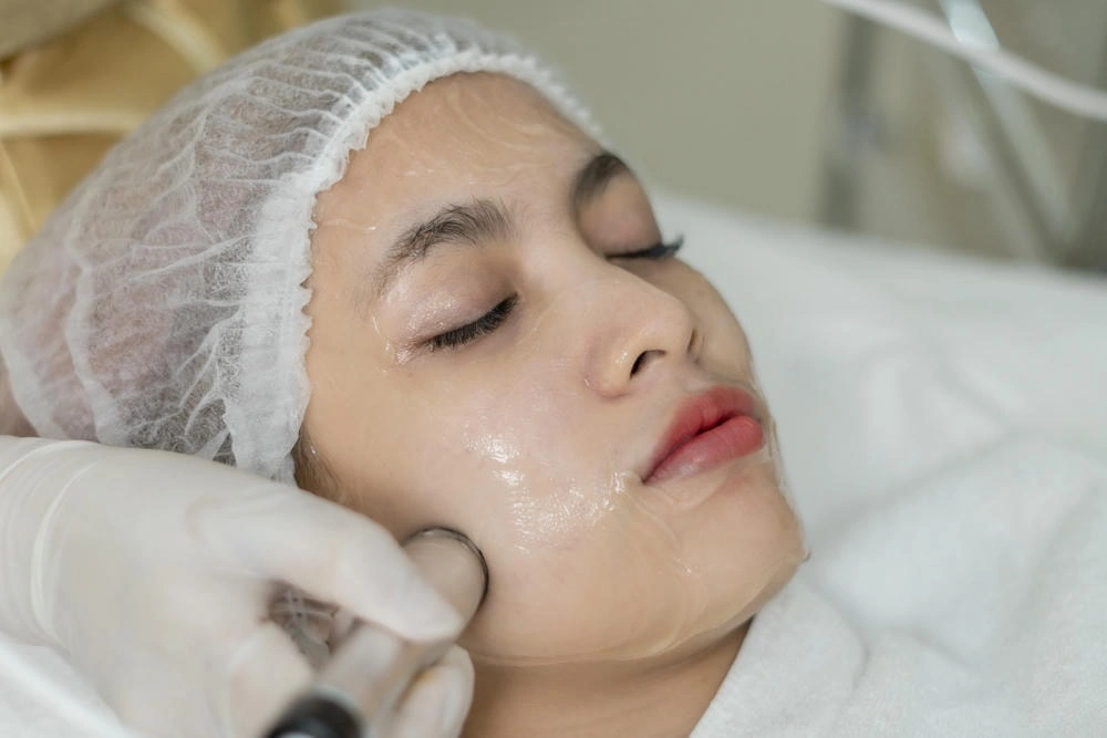 100+ Hình Ảnh Căng Chỉ Collagen 2026 - Bộ Sưu Tập Đẹp Nhất