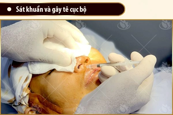 100+ Hình Ảnh Cắt Cánh Mũi 2026: Bộ Sưu Tập Đẹp Nhất, Đầy Đủ Mọi Phong Cách 100+ Hình Ảnh Cắt Cánh Mũi 2026: Bộ Sưu Tập Đẹp Nhất, Đầy Đủ Mọi Phong Cách