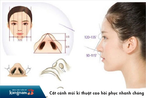 100+ Hình Ảnh Cắt Cánh Mũi 2026: Bộ Sưu Tập Đẹp Nhất, Đầy Đủ Mọi Phong Cách 100+ Hình Ảnh Cắt Cánh Mũi 2026: Bộ Sưu Tập Đẹp Nhất, Đầy Đủ Mọi Phong Cách