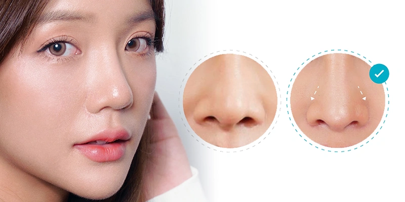 100+ Hình Ảnh Cắt Cánh Mũi 2026: Bộ Sưu Tập Đẹp Nhất, Đầy Đủ Mọi Phong Cách 100+ Hình Ảnh Cắt Cánh Mũi 2026: Bộ Sưu Tập Đẹp Nhất, Đầy Đủ Mọi Phong Cách