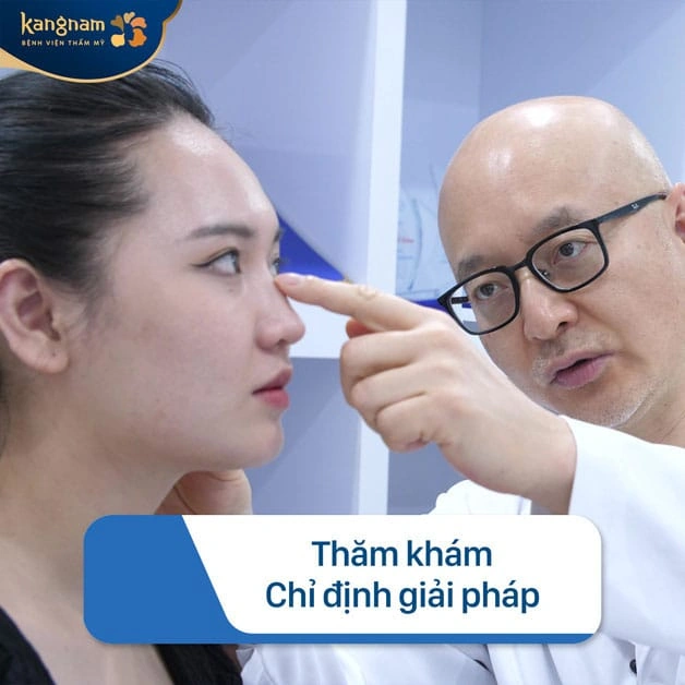 100+ Hình Ảnh Cắt Cánh Mũi 2026: Bộ Sưu Tập Đẹp Nhất, Đầy Đủ Mọi Phong Cách 100+ Hình Ảnh Cắt Cánh Mũi 2026: Bộ Sưu Tập Đẹp Nhất, Đầy Đủ Mọi Phong Cách