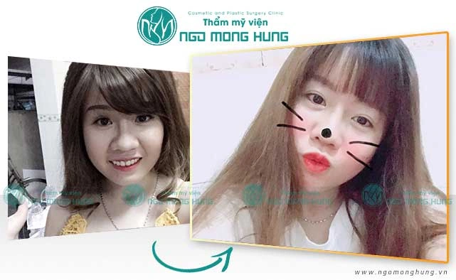 100+ Hình Ảnh Cắt Cánh Mũi 2026: Bộ Sưu Tập Đẹp Nhất, Đầy Đủ Mọi Phong Cách 100+ Hình Ảnh Cắt Cánh Mũi 2026: Bộ Sưu Tập Đẹp Nhất, Đầy Đủ Mọi Phong Cách