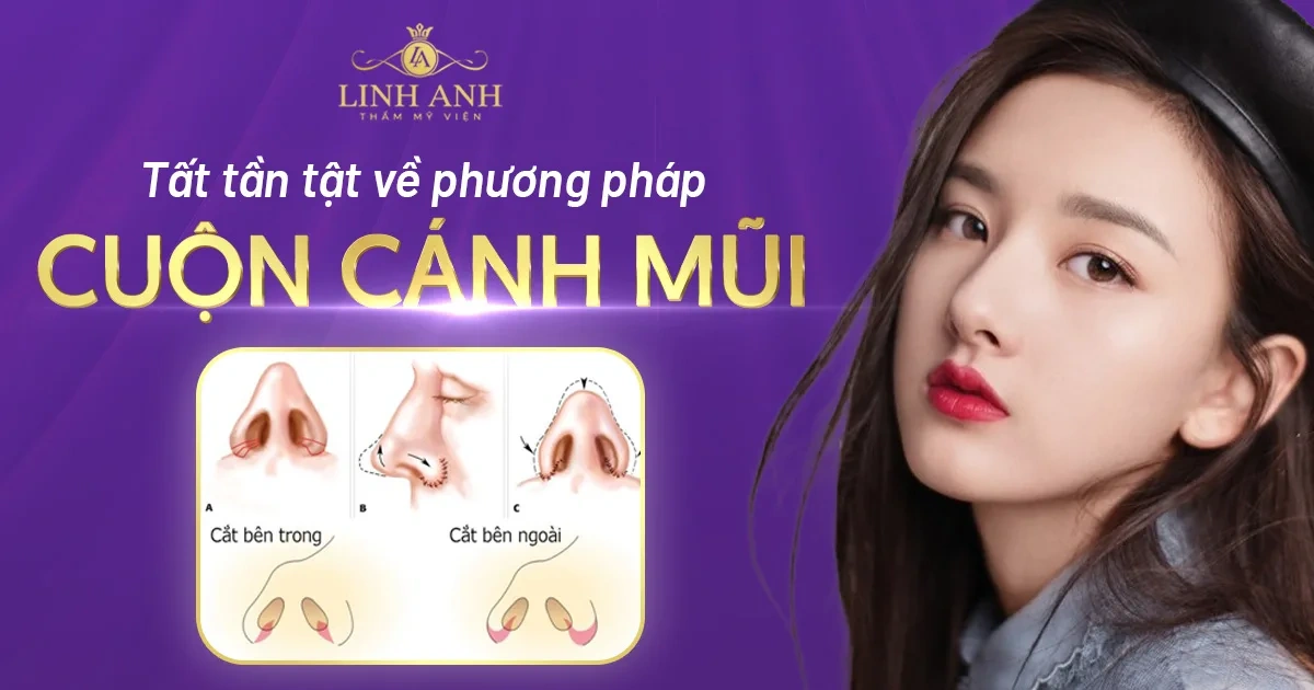100+ Hình Ảnh Cắt Cánh Mũi 2026: Bộ Sưu Tập Đẹp Nhất, Đầy Đủ Mọi Phong Cách 100+ Hình Ảnh Cắt Cánh Mũi 2026: Bộ Sưu Tập Đẹp Nhất, Đầy Đủ Mọi Phong Cách