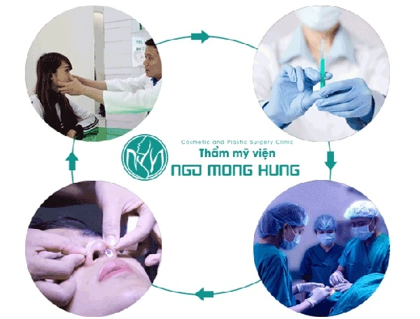 100+ Hình Ảnh Cắt Cánh Mũi 2026: Bộ Sưu Tập Đẹp Nhất, Đầy Đủ Mọi Phong Cách 100+ Hình Ảnh Cắt Cánh Mũi 2026: Bộ Sưu Tập Đẹp Nhất, Đầy Đủ Mọi Phong Cách
