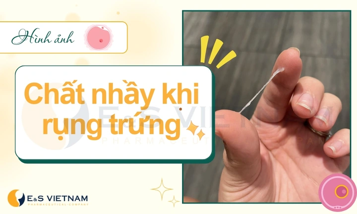 Hình Ảnh Chất Nhầy Khi Rụng Trứng: Cách Nhận Biết, Thời Gian Xuất Hiện & Ý Nghĩa Cho Phụ Nữ Muốn Mang Thai Hình Ảnh Chất Nhầy Khi Rụng Trứng: Cách Nhận Biết, Thời Gian Xuất Hiện & Ý Nghĩa Cho Phụ Nữ Muốn Mang Thai