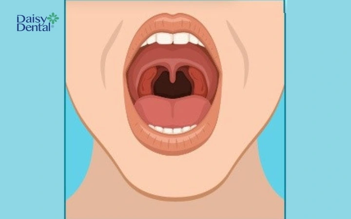 Hình Ảnh Cổ Họng Người Bình Thường: Đánh Giá, Nhận Diện & So Sánh Cho Người Tự Kiểm Tra Và Chuyên Gia Y Tế Hình Ảnh Cổ Họng Người Bình Thường: Đánh Giá, Nhận Diện & So Sánh Cho Người Tự Kiểm Tra Và Chuyên Gia Y Tế