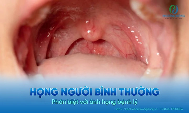 Hình Ảnh Cổ Họng Người Bình Thường: Đánh Giá, Nhận Diện & So Sánh Cho Người Tự Kiểm Tra Và Chuyên Gia Y Tế Hình Ảnh Cổ Họng Người Bình Thường: Đánh Giá, Nhận Diện & So Sánh Cho Người Tự Kiểm Tra Và Chuyên Gia Y Tế