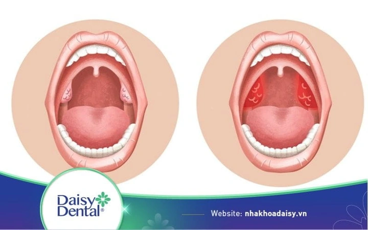 Hình Ảnh Cổ Họng Người Bình Thường: Đánh Giá, Nhận Diện & So Sánh Cho Người Tự Kiểm Tra Và Chuyên Gia Y Tế Hình Ảnh Cổ Họng Người Bình Thường: Đánh Giá, Nhận Diện & So Sánh Cho Người Tự Kiểm Tra Và Chuyên Gia Y Tế
