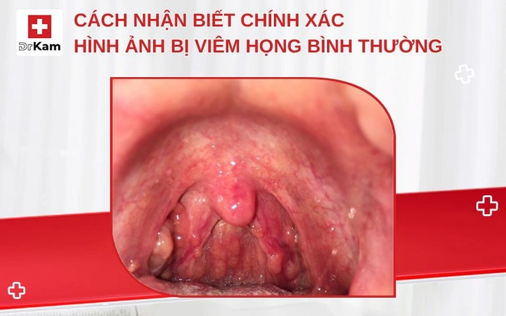 Hình Ảnh Cổ Họng Người Bình Thường: Đánh Giá, Nhận Diện & So Sánh Cho Người Tự Kiểm Tra Và Chuyên Gia Y Tế Hình Ảnh Cổ Họng Người Bình Thường: Đánh Giá, Nhận Diện & So Sánh Cho Người Tự Kiểm Tra Và Chuyên Gia Y Tế