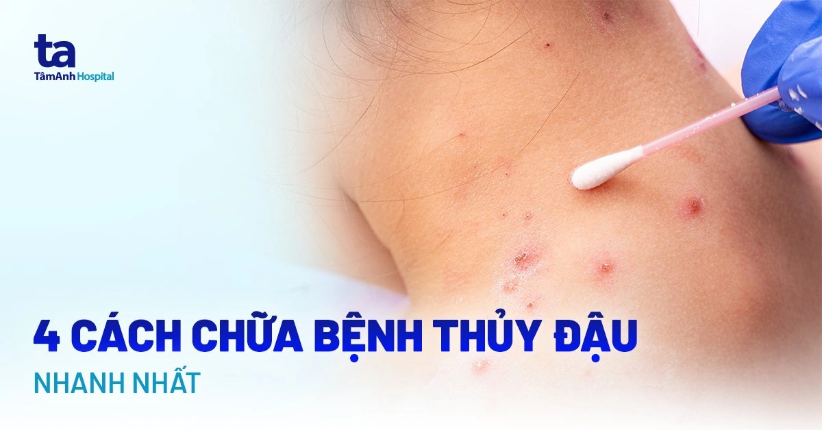 100+ Hình Ảnh Thủy Đậu 4k Đẹp Nhất 2026, Bộ Sưu Tập Đầy Đủ Cho Mọi Nhu Cầu? 100+ Hình Ảnh Thủy Đậu 4k Đẹp Nhất 2026, Bộ Sưu Tập Đầy Đủ Cho Mọi Nhu Cầu?