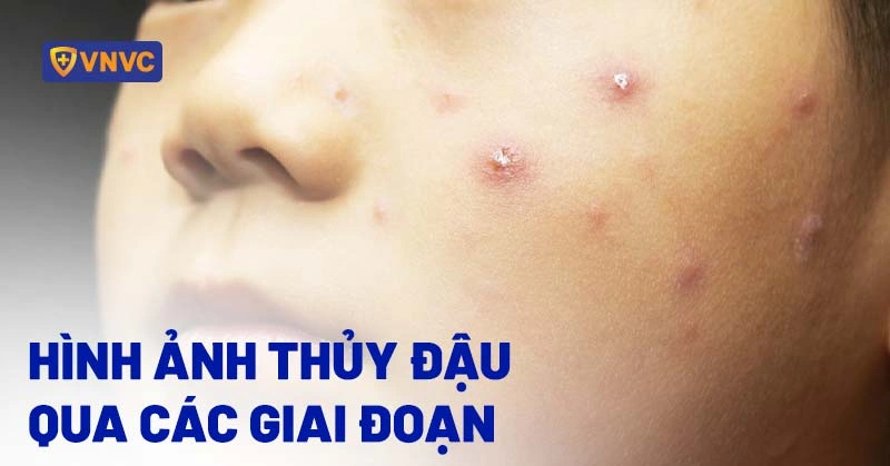 100+ Hình Ảnh Thủy Đậu 4k Đẹp Nhất 2026, Bộ Sưu Tập Đầy Đủ Cho Mọi Nhu Cầu? 100+ Hình Ảnh Thủy Đậu 4k Đẹp Nhất 2026, Bộ Sưu Tập Đầy Đủ Cho Mọi Nhu Cầu?