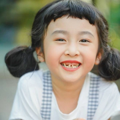 Hình Ảnh Em Bé Sún Răng: Nhận Dạng, Nguyên Nhân & Cách Điều Trị Hiệu Quả Cho Mẹ Bỉm Sữa Hình Ảnh Em Bé Sún Răng: Nhận Dạng, Nguyên Nhân & Cách Điều Trị Hiệu Quả Cho Mẹ Bỉm Sữa