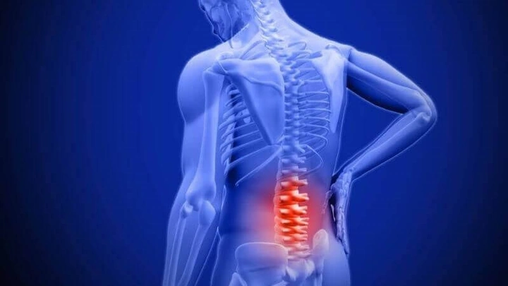 Hình Ảnh Gai Cột Sống Thắt Lưng: Định Nghĩa, Nguyên Nhân, Triệu Chứng & Cách Điều Trị Dành Cho Người Mới Bắt Đầu