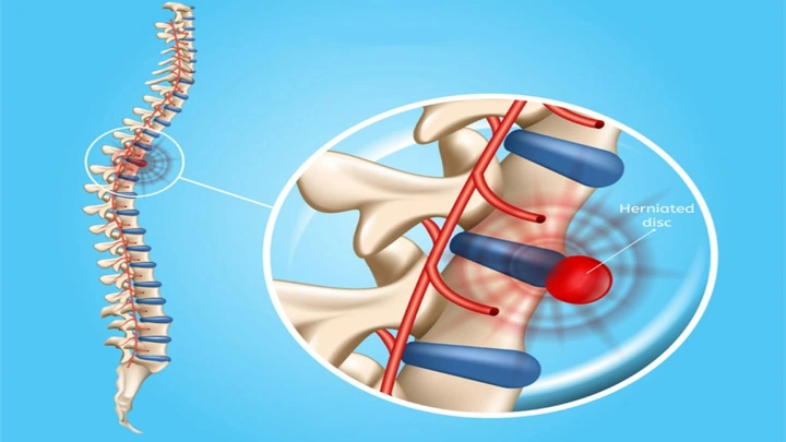 Hình Ảnh Giải Phẫu Khớp Vai: Cấu Trúc Chi Tiết, Bệnh Lý Thường Gặp Và Ứng Dụng Lâm Sàng Cho Sinh Viên Y & Bác Sĩ