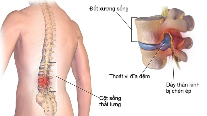Hình Ảnh Giải Phẫu Khớp Vai: Cấu Trúc Chi Tiết, Bệnh Lý Thường Gặp Và Ứng Dụng Lâm Sàng Cho Sinh Viên Y & Bác Sĩ