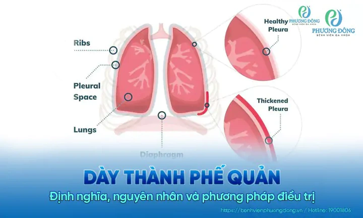 Hình Ảnh Màng Trinh Dày: Cách Nhận Biết, Đánh Giá Và Xử Trợ Cho Các Bạn Trẻ (đối Tượng Nữ Tuổi Teen‑teen)