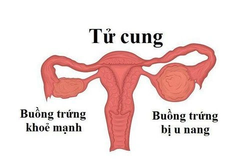 Hình Ảnh Màng Trinh Dày: Cách Nhận Biết, Đánh Giá Và Xử Trợ Cho Các Bạn Trẻ (đối Tượng Nữ Tuổi Teen‑teen)