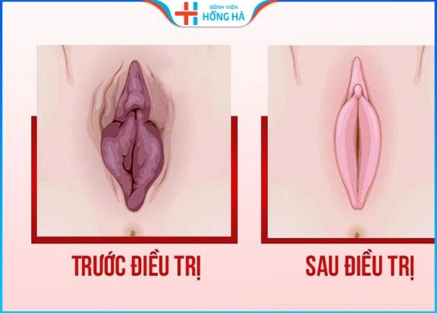 100+ Hình Ảnh Môi Bé Dài Đẹp Đầy Phong Cách 2026 – Bạn Đã Xem Chưa?