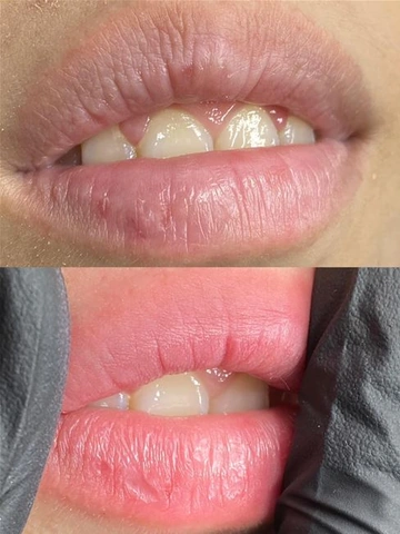 Hình Ảnh Môi Phun Xăm Đẹp: Bộ Sưu Tập Mẫu Thực Tế, Cách Chọn Màu & Tránh Sai Lầm Cho Phụ Nữ Hiện Đại