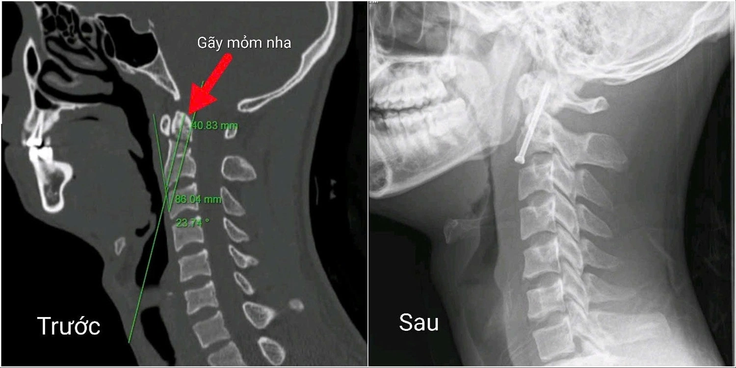 100+ Hình Ảnh Mom Sông Đẹp Nhất 2026 – Bộ Sưu Tập Đầy Đủ Cho Mọi Nhu Cầu 100+ Hình Ảnh Mom Sông Đẹp Nhất 2026 – Bộ Sưu Tập Đầy Đủ Cho Mọi Nhu Cầu
