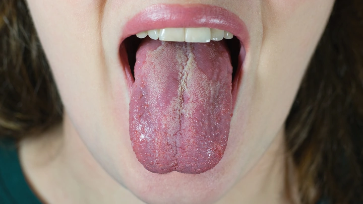 Hình Ảnh Người Bị Nhiễm Hiv/aids: Nhận Dạng, Triệu Chứng & Phân Biệt Đúng Đối Tượng