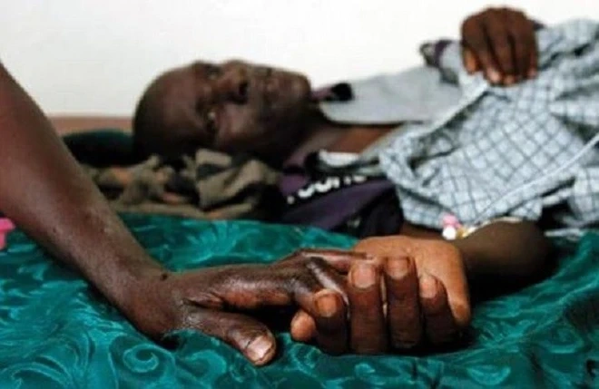 Hình Ảnh Người Bị Nhiễm Hiv/aids: Nhận Dạng, Triệu Chứng & Phân Biệt Đúng Đối Tượng