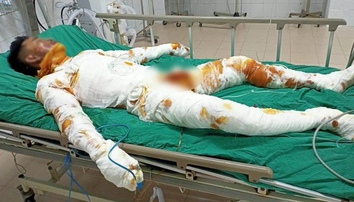 Hình Ảnh Người Bị Điện Giật: Cách Nhận Biết, Sơ Cứu Và Phòng Ngừa – Dành Cho Người Dân Và Nhân Viên Cứu Hộ