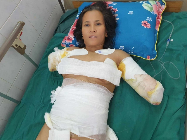 Hình Ảnh Người Bị Điện Giật: Cách Nhận Biết, Sơ Cứu Và Phòng Ngừa – Dành Cho Người Dân Và Nhân Viên Cứu Hộ
