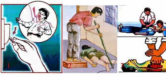 Hình Ảnh Người Bị Điện Giật: Cách Nhận Biết, Sơ Cứu Và Phòng Ngừa – Dành Cho Người Dân Và Nhân Viên Cứu Hộ