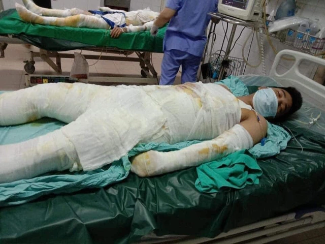 Hình Ảnh Người Bị Điện Giật: Cách Nhận Biết, Sơ Cứu Và Phòng Ngừa – Dành Cho Người Dân Và Nhân Viên Cứu Hộ