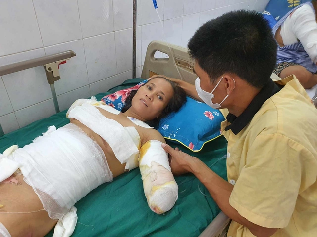 Hình Ảnh Người Bị Điện Giật: Cách Nhận Biết, Sơ Cứu Và Phòng Ngừa – Dành Cho Người Dân Và Nhân Viên Cứu Hộ