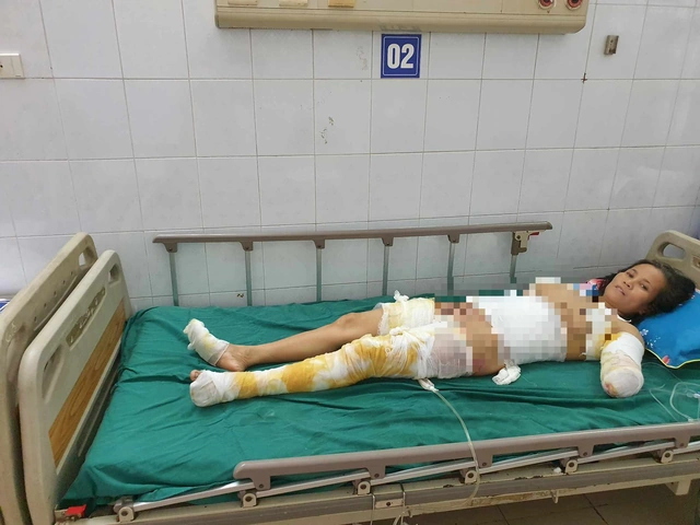 Hình Ảnh Người Bị Điện Giật: Cách Nhận Biết, Sơ Cứu Và Phòng Ngừa – Dành Cho Người Dân Và Nhân Viên Cứu Hộ