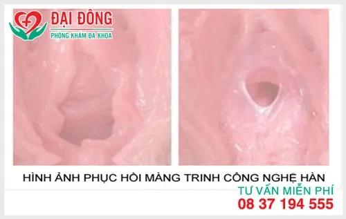 100+ Hình Ảnh Phá Trinh Độc Quyền 2026 – Bộ Sưu Tập Đẹp Nhất, Đầy Đủ Mọi Phong Cách Bạn Muốn, 100+ Bức Ảnh Siêu Sắc Nét Cho Dự Án Sáng Tạo Của Bạn 100+ Hình Ảnh Phá Trinh Độc Quyền 2026 – Bộ Sưu Tập Đẹp Nhất, Đầy Đủ Mọi Phong Cách Bạn Muốn, 100+ Bức Ảnh Siêu Sắc Nét Cho Dự Án Sáng Tạo Của Bạn
