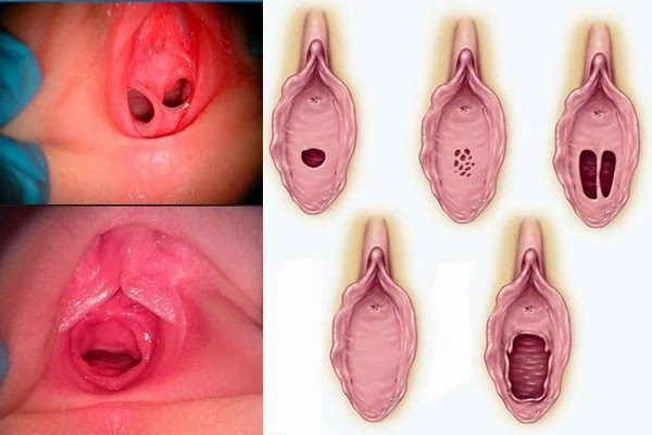100+ Hình Ảnh Phá Trinh Độc Quyền 2026 – Bộ Sưu Tập Đẹp Nhất, Đầy Đủ Mọi Phong Cách Bạn Muốn, 100+ Bức Ảnh Siêu Sắc Nét Cho Dự Án Sáng Tạo Của Bạn 100+ Hình Ảnh Phá Trinh Độc Quyền 2026 – Bộ Sưu Tập Đẹp Nhất, Đầy Đủ Mọi Phong Cách Bạn Muốn, 100+ Bức Ảnh Siêu Sắc Nét Cho Dự Án Sáng Tạo Của Bạn
