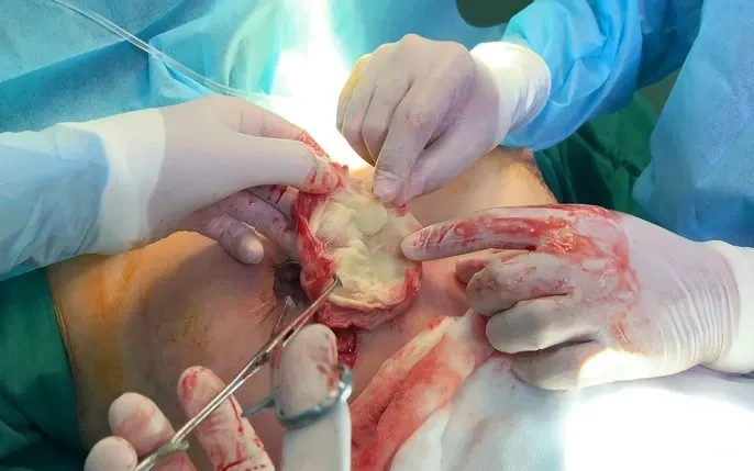 Hình Ảnh Phẫu Thuật Thẩm Mỹ Trước Sau: Tổng Hợp Kết Quả Thành Công Và Thất Bại Cho Người Quan Tâm Hình Ảnh Phẫu Thuật Thẩm Mỹ Trước Sau: Tổng Hợp Kết Quả Thành Công Và Thất Bại Cho Người Quan Tâm